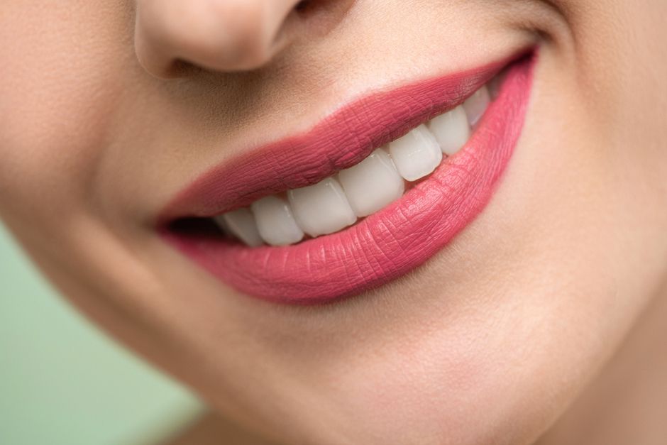 Gros plan d'un sourire aux dents blanches, illustrant des gencives saines