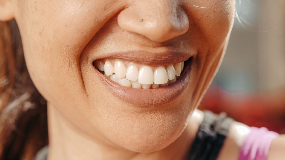Sourire naturel avec des dents bien alignées, reflet d'un bon équilibre entre langue, mâchoire et respiration